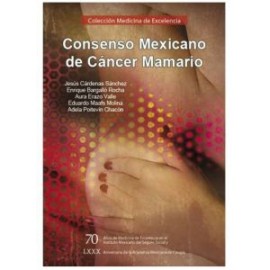Consenso mexicano de Cáncer mamario