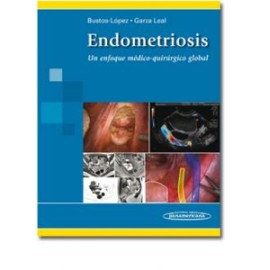 Endometriosis. Un enfoque médico-quirúrgico global  (Panamericana)
