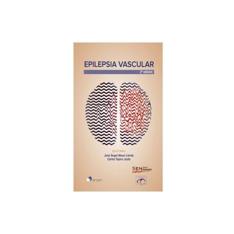 Epilepsia vascular 2a. edición (ergon)