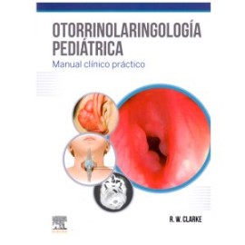 Otorrinolaringología pediátrica