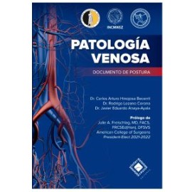 Patología Venosa. Documento de Postura