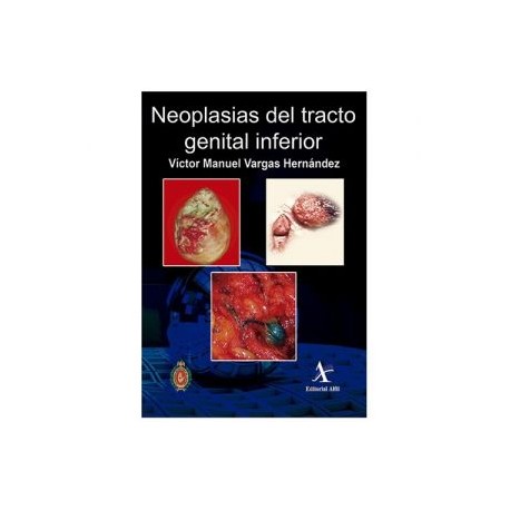 Neoplasias del tracto genital inferior (Alfil)
